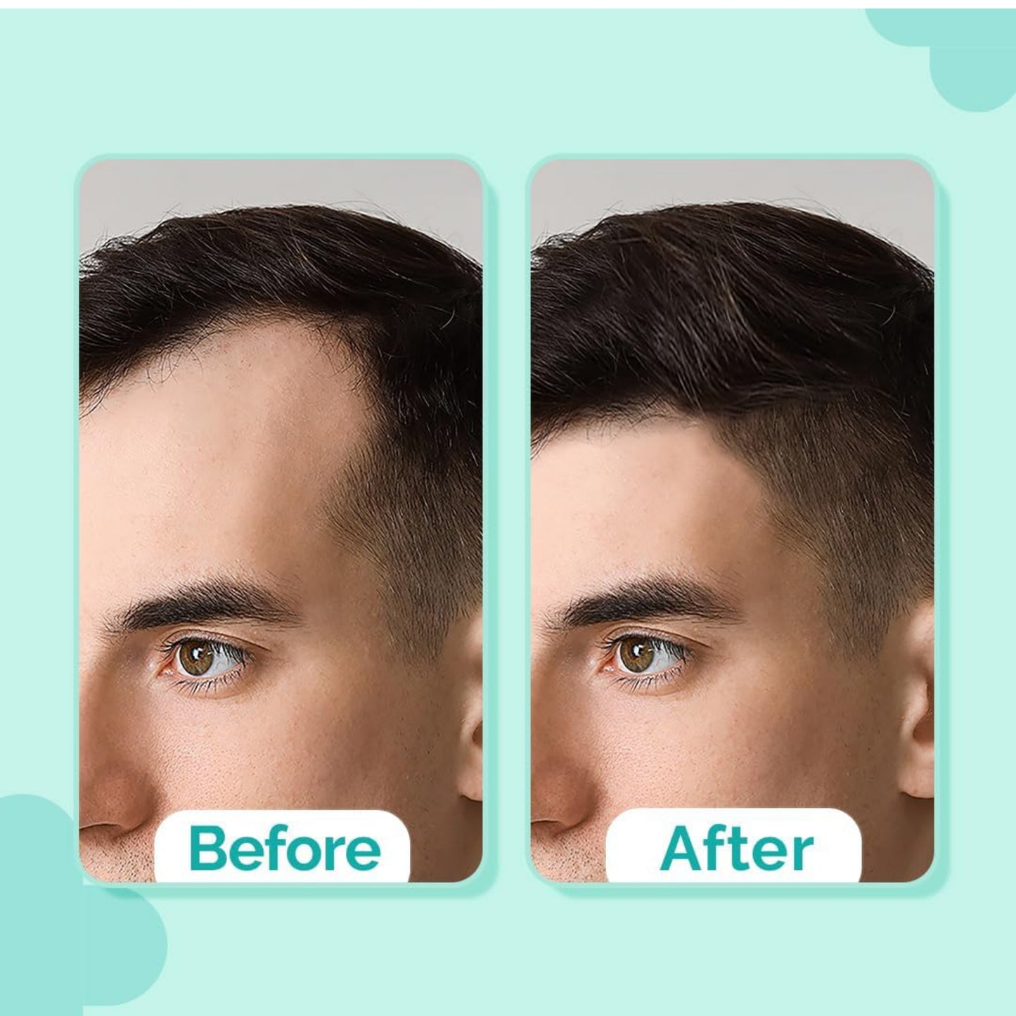 Stops Hair Fall Shampoo